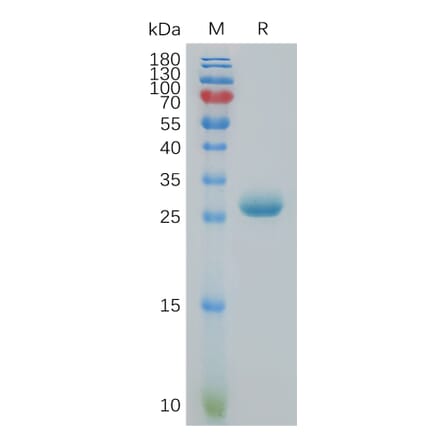 SDS-PAGE - Recombinant Human BTN3A3 Protein (6×His Tag) (A317830) - Antibodies.com