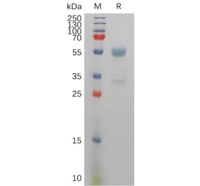 SDS-PAGE - Recombinant Human CD94 Protein (Fc Tag) (A317831) - Antibodies.com