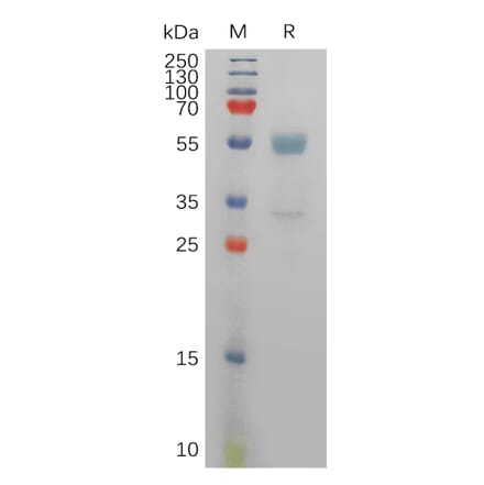 SDS-PAGE - Recombinant Human CD94 Protein (Fc Tag) (A317831) - Antibodies.com