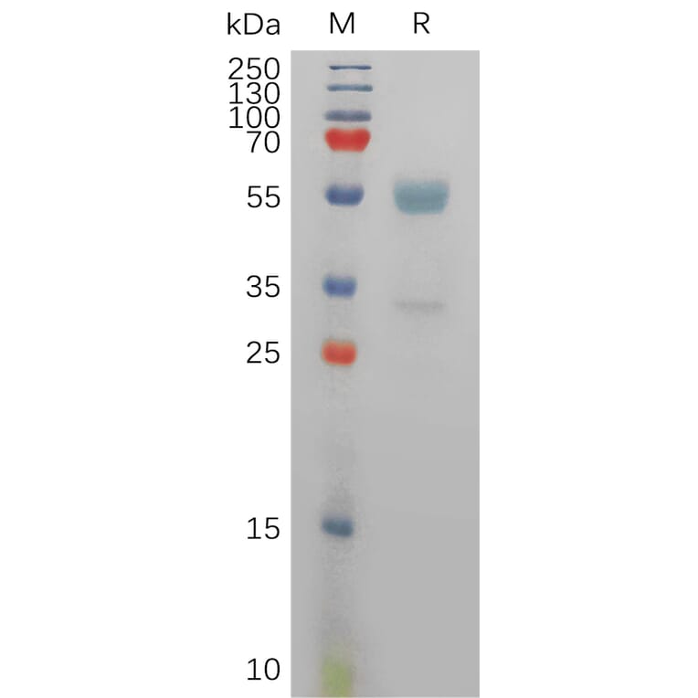 SDS-PAGE - Recombinant Human CD94 Protein (Fc Tag) (A317831) - Antibodies.com