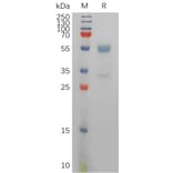SDS-PAGE - Recombinant Human CD94 Protein (Fc Tag) (A317831) - Antibodies.com