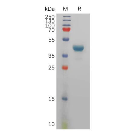 SDS-PAGE - Recombinant Human Tspan-8 Protein (Fc Tag) (A317832) - Antibodies.com