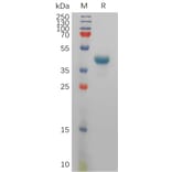 SDS-PAGE - Recombinant Human Tspan-8 Protein (Fc Tag) (A317832) - Antibodies.com
