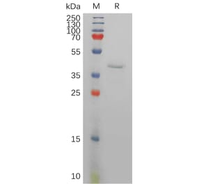 SDS-PAGE - Recombinant Human Resistin Protein (Fc Tag) (A317834) - Antibodies.com