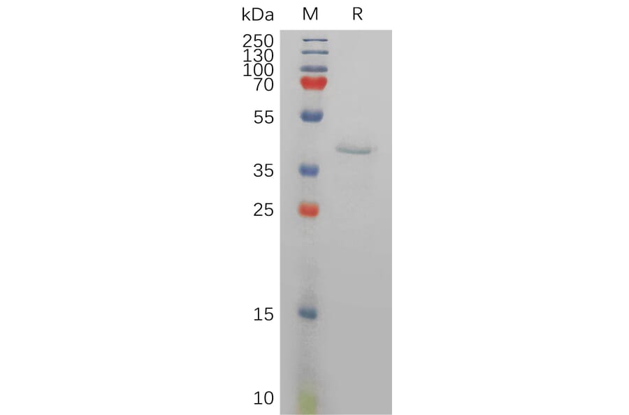 SDS-PAGE - Recombinant Human Resistin Protein (Fc Tag) (A317834) - Antibodies.com