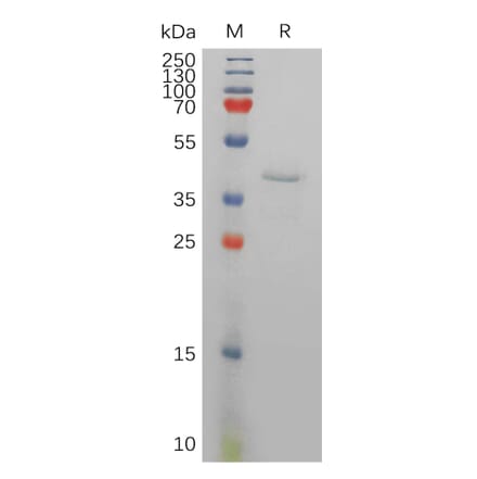 SDS-PAGE - Recombinant Human Resistin Protein (Fc Tag) (A317834) - Antibodies.com