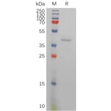 SDS-PAGE - Recombinant Human Resistin Protein (Fc Tag) (A317834) - Antibodies.com