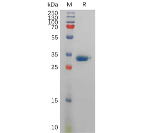 SDS-PAGE - Recombinant Human Prostate Specific Antigen Protein (6×His Tag) (A317835) - Antibodies.com