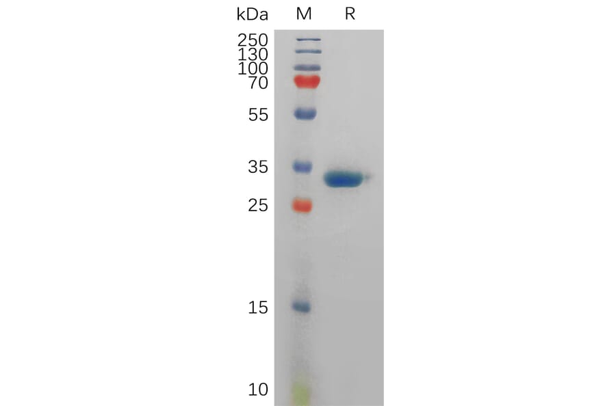 SDS-PAGE - Recombinant Human Prostate Specific Antigen Protein (6×His Tag) (A317835) - Antibodies.com