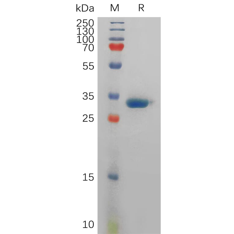 SDS-PAGE - Recombinant Human Prostate Specific Antigen Protein (6×His Tag) (A317835) - Antibodies.com