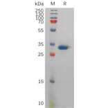 SDS-PAGE - Recombinant Human Prostate Specific Antigen Protein (6×His Tag) (A317835) - Antibodies.com
