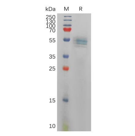 SDS-PAGE - Recombinant Human IL-12B Protein (6×His Tag) (A317836) - Antibodies.com