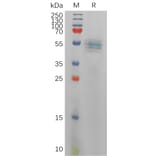 SDS-PAGE - Recombinant Human IL-12B Protein (6×His Tag) (A317836) - Antibodies.com