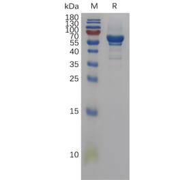 SDS-PAGE - Recombinant Human Amphiregulin Protein (Fc Tag) (A317837) - Antibodies.com