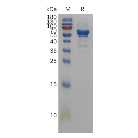 SDS-PAGE - Recombinant Human Amphiregulin Protein (Fc Tag) (A317837) - Antibodies.com