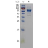 SDS-PAGE - Recombinant Human Amphiregulin Protein (Fc Tag) (A317837) - Antibodies.com