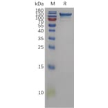 SDS-PAGE - Recombinant Human Semaphorin 4D/CD100 Protein (6×His Tag) (A317838) - Antibodies.com