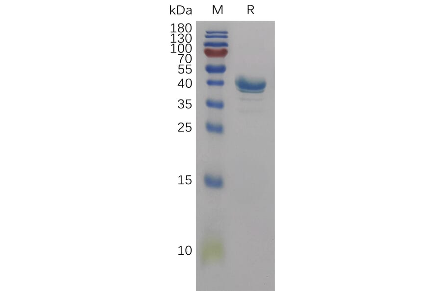 SDS-PAGE - Recombinant Human CD59 Protein (Fc Tag) (A317839) - Antibodies.com