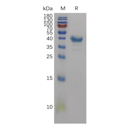 SDS-PAGE - Recombinant Human CD59 Protein (Fc Tag) (A317839) - Antibodies.com