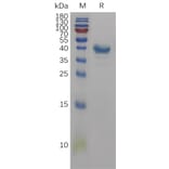 SDS-PAGE - Recombinant Human CD59 Protein (Fc Tag) (A317839) - Antibodies.com