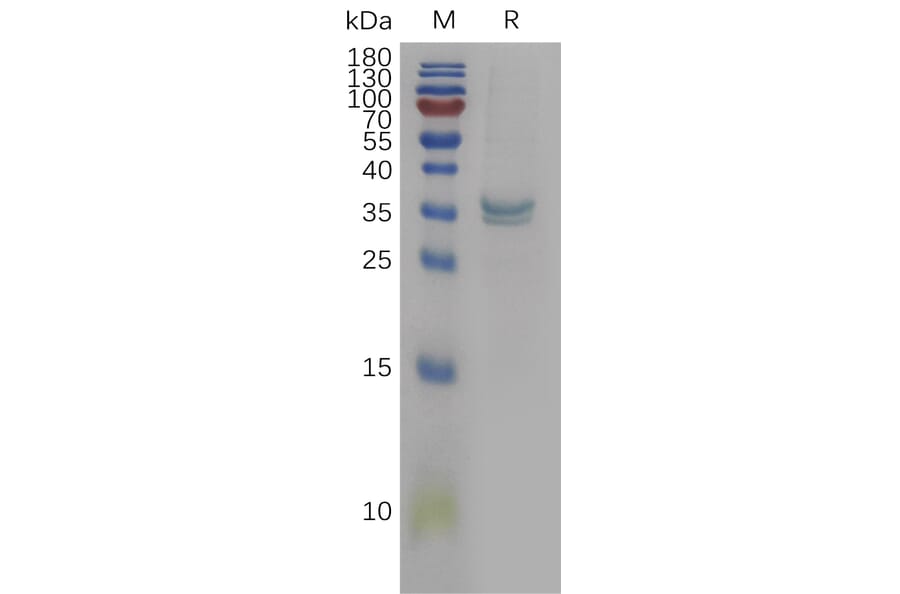 SDS-PAGE - Recombinant Human PPT1/PPT Protein (6×His Tag) (A317841) - Antibodies.com