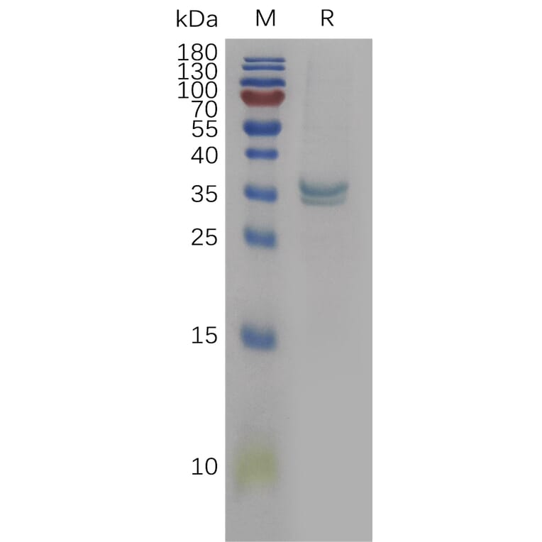 SDS-PAGE - Recombinant Human PPT1/PPT Protein (6×His Tag) (A317841) - Antibodies.com