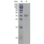 SDS-PAGE - Recombinant Human PPT1/PPT Protein (6×His Tag) (A317841) - Antibodies.com