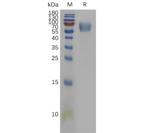 SDS-PAGE - Recombinant Human IL-18BP Protein (Fc Tag) (A317842) - Antibodies.com