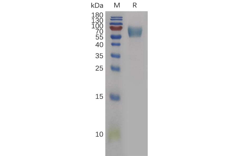 SDS-PAGE - Recombinant Human IL-18BP Protein (Fc Tag) (A317842) - Antibodies.com