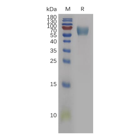 SDS-PAGE - Recombinant Human IL-18BP Protein (Fc Tag) (A317842) - Antibodies.com