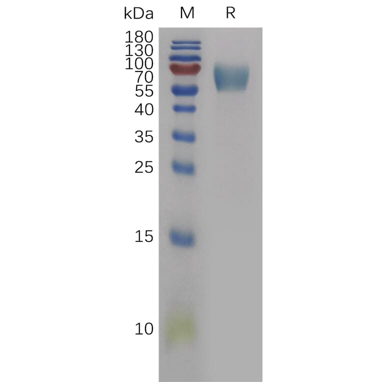 SDS-PAGE - Recombinant Human IL-18BP Protein (Fc Tag) (A317842) - Antibodies.com