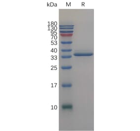 SDS-PAGE - Recombinant Human IGFBP2 Protein (6×His Tag) (A317843) - Antibodies.com