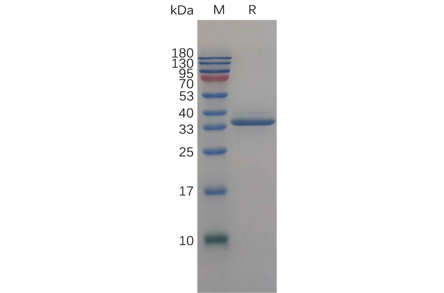 SDS-PAGE - Recombinant Human IGFBP2 Protein (6×His Tag) (A317843) - Antibodies.com