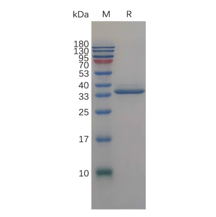SDS-PAGE - Recombinant Human IGFBP2 Protein (6×His Tag) (A317843) - Antibodies.com