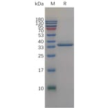 SDS-PAGE - Recombinant Human IGFBP2 Protein (6×His Tag) (A317843) - Antibodies.com