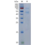 SDS-PAGE - Recombinant Human BMP6 Protein (6×His Tag) (A317845) - Antibodies.com