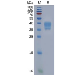 SDS-PAGE - Recombinant Human PAR2 Protein (Fc Tag) (A317848) - Antibodies.com