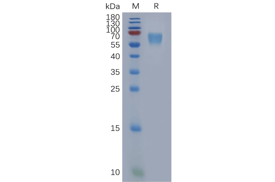 SDS-PAGE - Recombinant Human DEGA Protein (6×His Tag) (A317849) - Antibodies.com