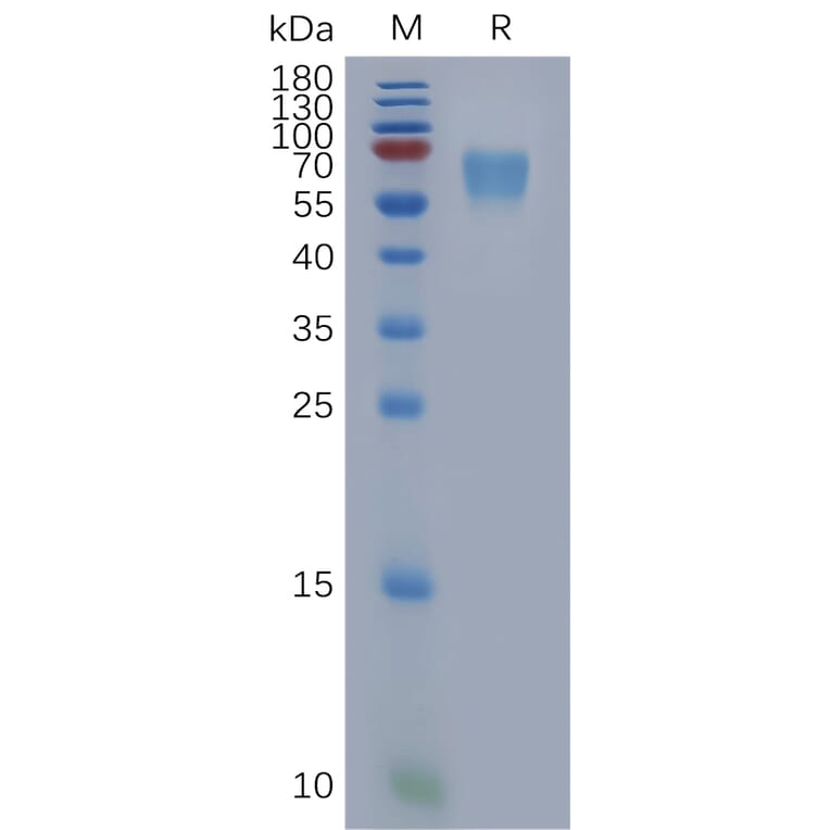 SDS-PAGE - Recombinant Human DEGA Protein (6×His Tag) (A317849) - Antibodies.com