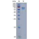SDS-PAGE - Recombinant Human DEGA Protein (6×His Tag) (A317849) - Antibodies.com