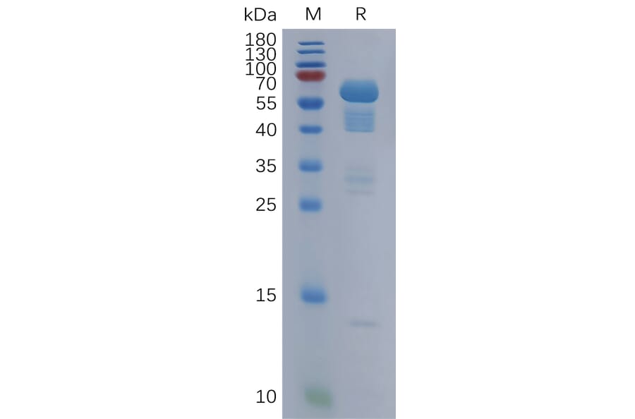 SDS-PAGE - Recombinant Human Secretogranin 3 Protein (6×His Tag) (A317850) - Antibodies.com