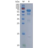 SDS-PAGE - Recombinant Human Secretogranin 3 Protein (6×His Tag) (A317850) - Antibodies.com