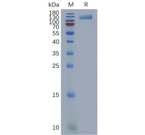 SDS-PAGE - Recombinant Human OSMR Protein (6×His Tag) (A317851) - Antibodies.com