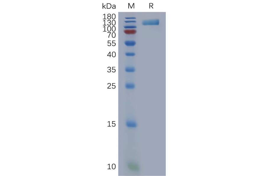 SDS-PAGE - Recombinant Human OSMR Protein (6×His Tag) (A317851) - Antibodies.com