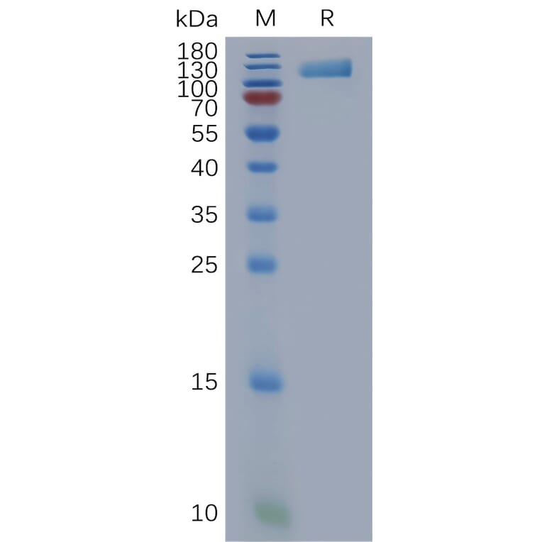SDS-PAGE - Recombinant Human OSMR Protein (6×His Tag) (A317851) - Antibodies.com