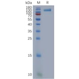 SDS-PAGE - Recombinant Human OSMR Protein (6×His Tag) (A317851) - Antibodies.com