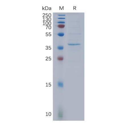 SDS-PAGE - Recombinant Human HSD17B13 Protein (3×Flag Tag) (A317852) - Antibodies.com