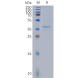 SDS-PAGE - Recombinant Human HSD17B13 Protein (3×Flag Tag) (A317852) - Antibodies.com