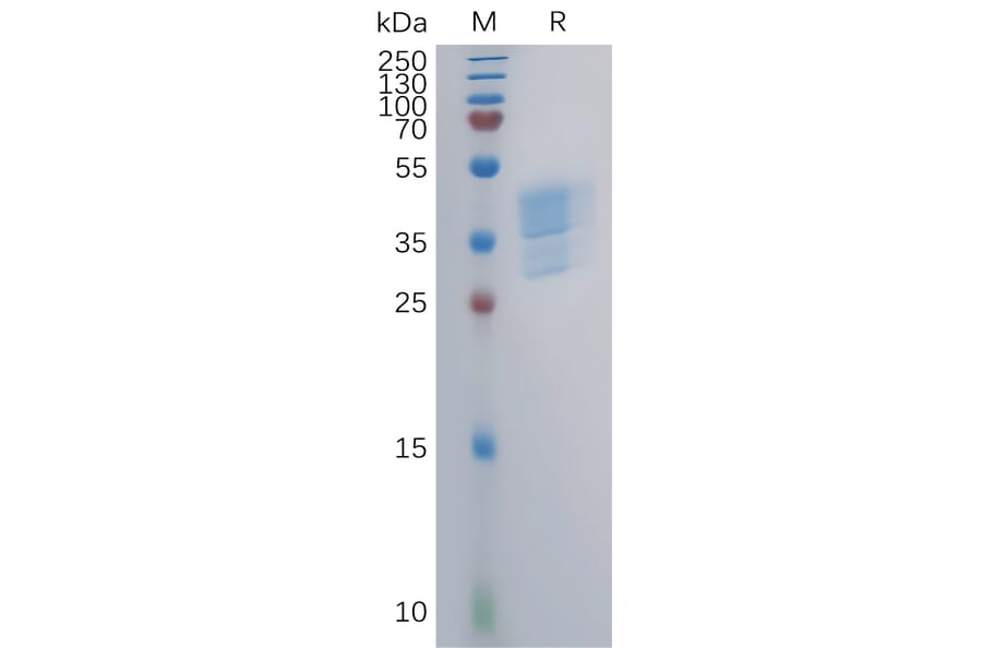 SDS-PAGE - Recombinant Human CCR4 Protein (Fc Tag) (A317853) - Antibodies.com