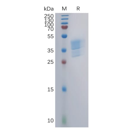 SDS-PAGE - Recombinant Human CCR4 Protein (Fc Tag) (A317853) - Antibodies.com